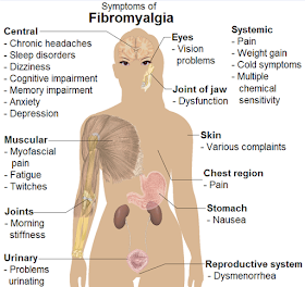 Fibromyalgia Symptoms female body