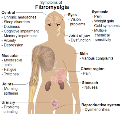 Fibromyalgia Symptoms female body