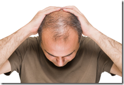 The-Best-Hair-Loss-Solution-Explained