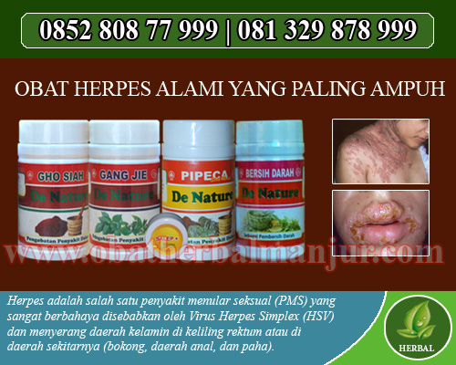 cara menyembuhkan sakit herpes