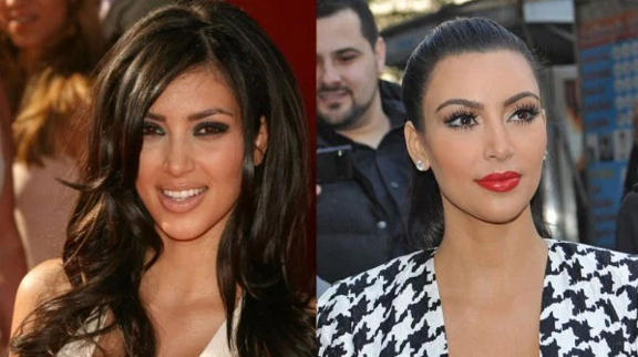 Kim Kardashian Plastic Surgery Before and After Nose Job, Botox and Facelift  Star Plastic 