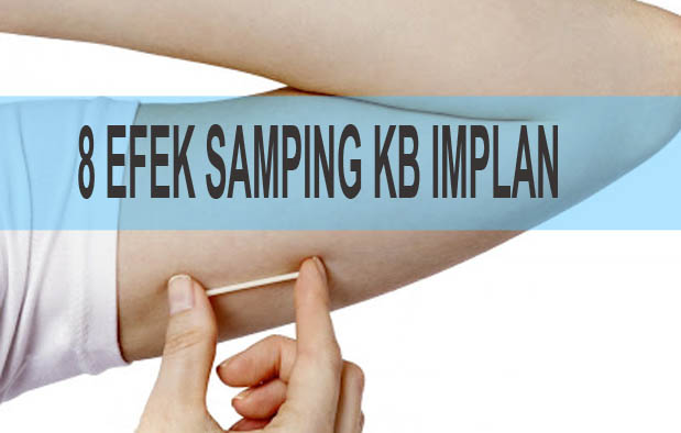 Efek Samping KB Implan