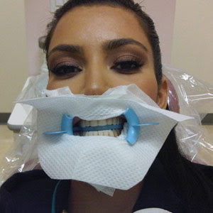  Kardashian  Pics on Autrement Plus Sexy Que Kim Kardashian Chez Le Dentiste