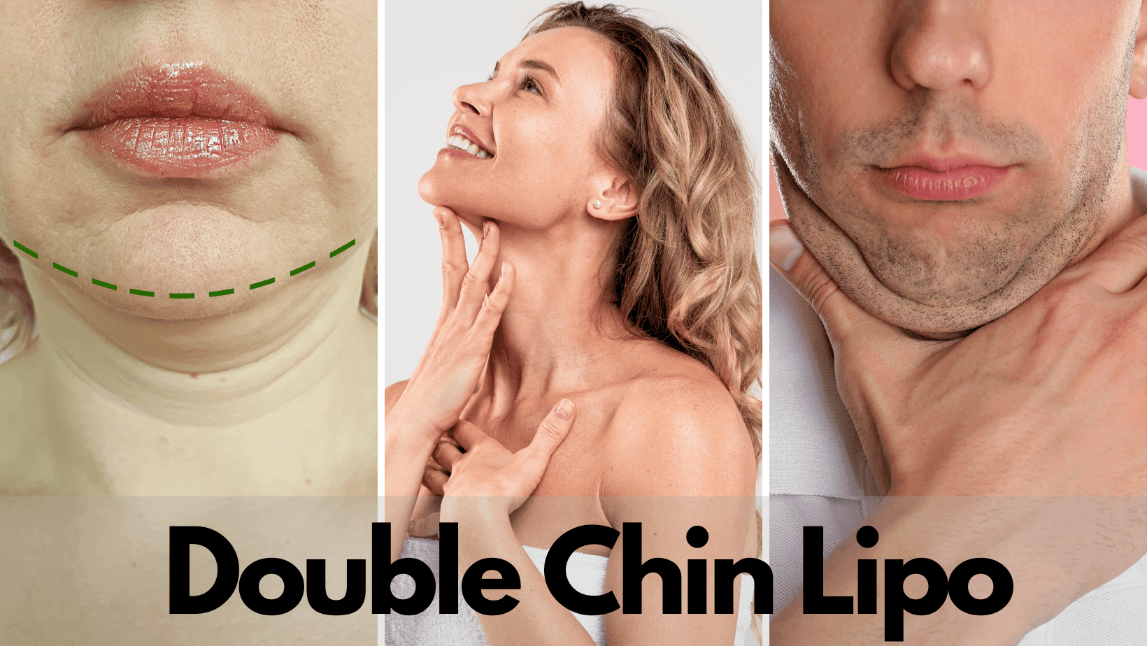 recovery-and-results-what-to-expect-from-double-chin-lipo-barbies-beauty-bits