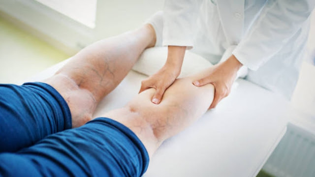 Varicose Vein Treatment Market