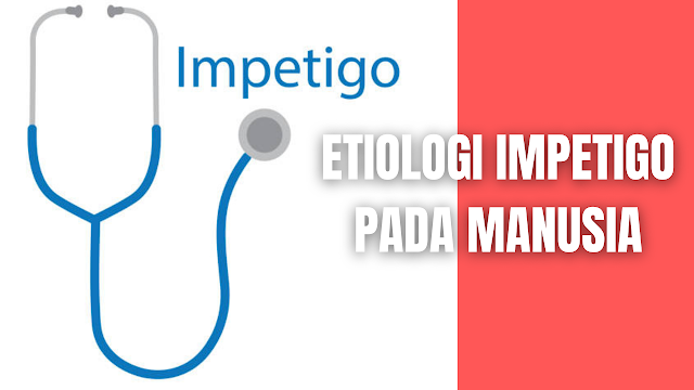 Etiologi Impetigo Pada Manusia Impetigo disebabkan oleh bakteri gram positif , paling sering Staphylococcus aureus dan Streptococcus pyogenes (grup A beta - hemolitik streptokokus [GABHS]), baik sendiri atau dalam kombinasi dan dapat disebabkan juga oleh Methicillin – resistant Staphylococcus aureus.  Streptokokus grup A terdapat di kulit normal anak sekitar 10 hari sebelum terjadinya lesi, tidak didapati di hidung dan di tenggorokan penderita sebelum 14-20 hari, setelah bakteri tersebut berada di kulit. Streptokokus dapat ditemukan di saluran pernapasan pada 30% penderita impetigo. Dapat disimpulkan bahwa penyebaran pada penderita dimulai dari kulit normal ke lesi dan juga ke saluran pernapasan. Untuk S.aureus adalah sebaliknya, mulai dari hidung ke kulit normal dan ke lesi kulit.    Nah itu dia bahasan dari etiologi impetigo pada manusia, melalui bahasan di atas bisa diketahui mengenai etiologi impetigo pada manusia. Mungkin hanya itu yang bisa disampaikan di dalam artikel ini, mohon maaf bila terjadi kesalahan di dalam penulisan, dan terimakasih telah membaca artikel ini."God Bless and Protect Us"