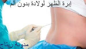 إبرة الظهر Epidural للتخلص من آلام الولادة، كيفية إعطائها، مميزاتها، أضرارها و موانع إستعمالها