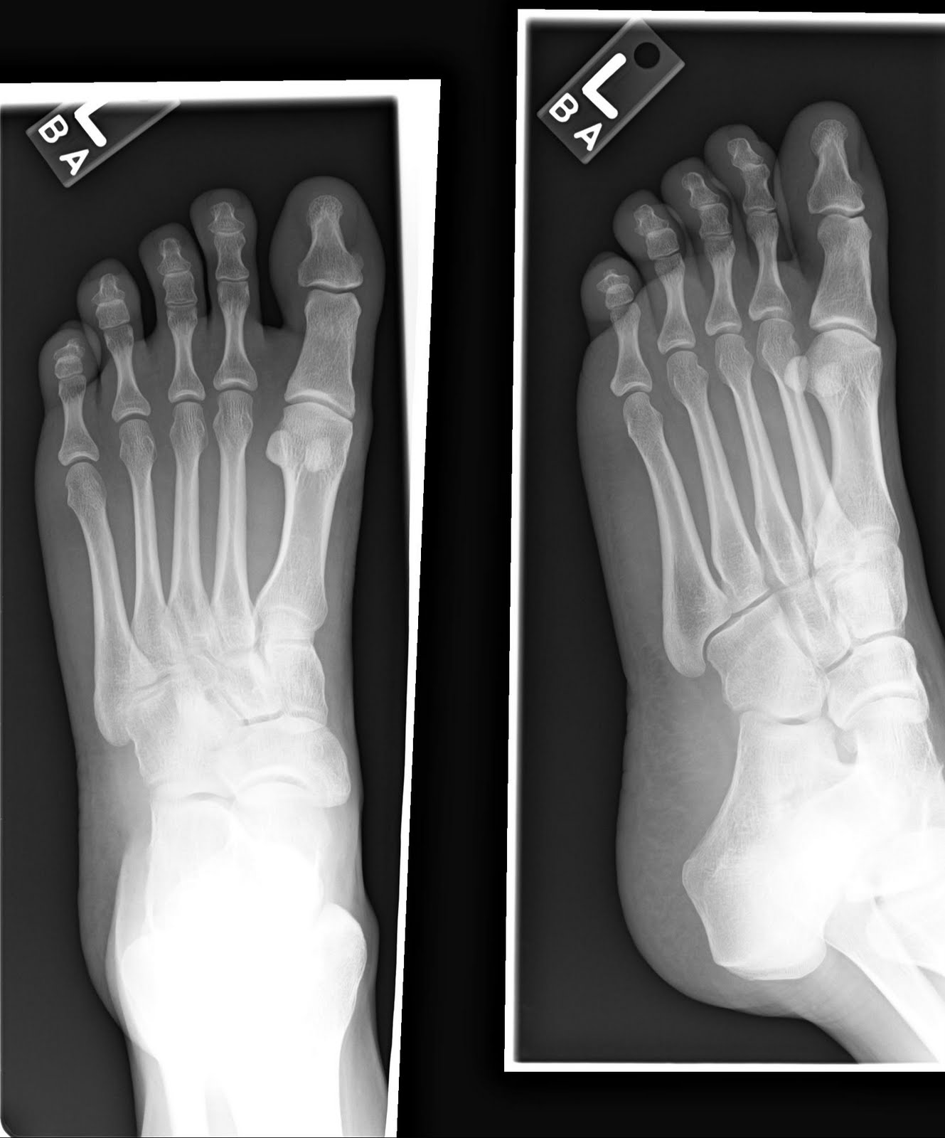 and Some Cool X Rays