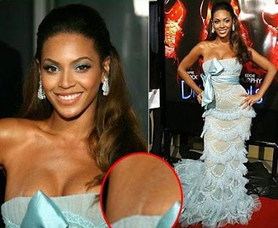 Beyonce Knowles Scar 