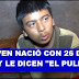 JOVEN NACE CON 26 DEDOS Y LO MOLESTAN DICIÉNDOLE "EL PULPO"