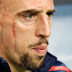 Ribery Cedera, Gagal Tampil Di PD 2014 Brasil ?