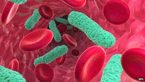 Vi khuẩn xâm nhập vào mạch máu.