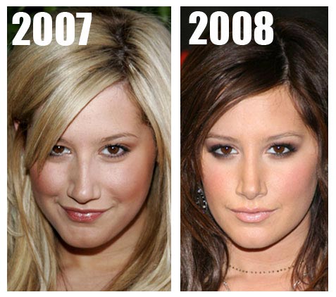 ashley tisdale nose job before after. Ashley Tisdale is another one