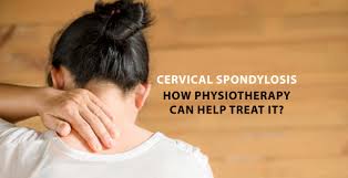 Cervical spondylosis