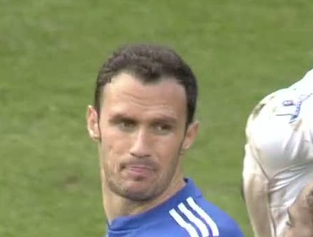 david beckham hair transplant. had a hair transplant.