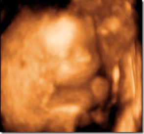 BABY GIRL_5