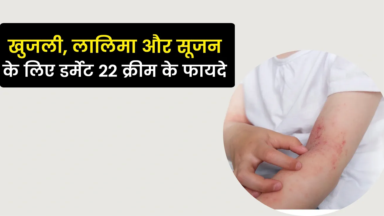 Dermat 22 Skin Care Cream in Hindi