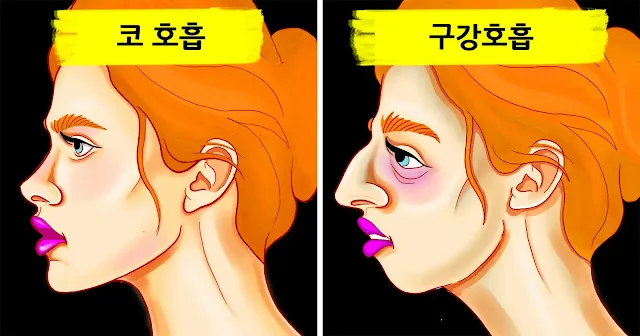 구강호흡의 중요성
