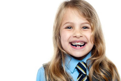Điều chỉnh khuyết điểm răng hô vẩu