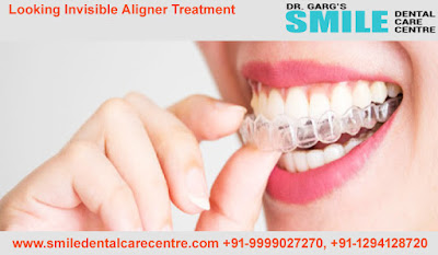 Best Invisible Aligner Treatment