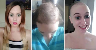 Viral Konyol, Wanita Itu Hoby Mencabuti Rambut Sampai Botak