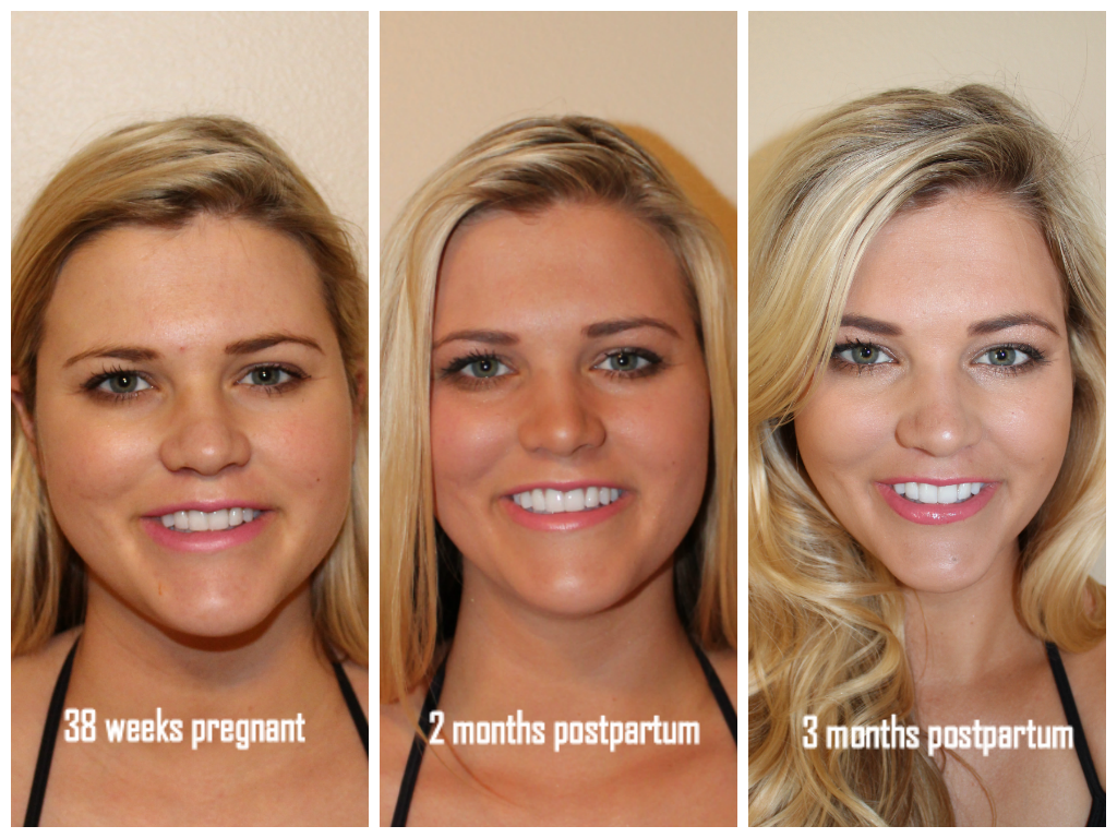 face slimming exercises before and after 0 2