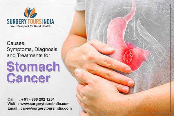 stomach-cancer-treatment-in-india