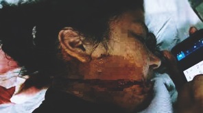 Mujer encuentra otra con su marido y le desfigura el rostro Mujer encuentra otra con su marido y le desfigura el rostro