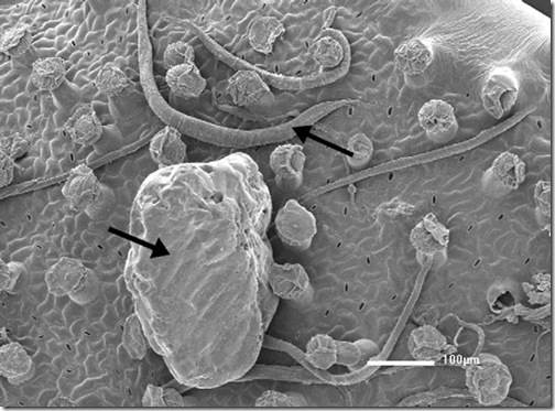 philcoxia_nematodo