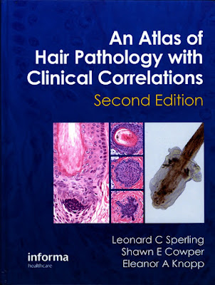Sperling's pioneering book An Atlas of Hair Pathology with Clinical Correlations. It addresses the clinicopathological diagnosis of diseases that result in alopecia. (Courtesy of Dr. Sperling)