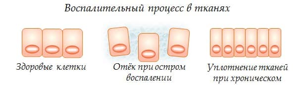 Изменения в тканях при воспалении