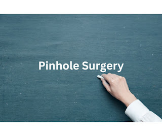 Pinhole Surgical Technique