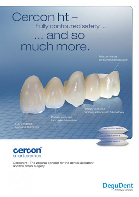 Răng sứ cercon ht như thế nào?