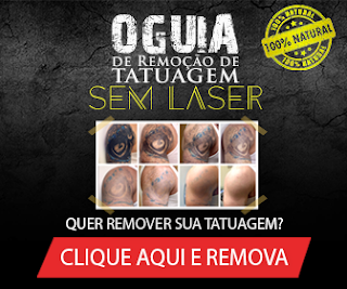 o-guia-de-remoção-de-tatuagem-sem-laser-funciona