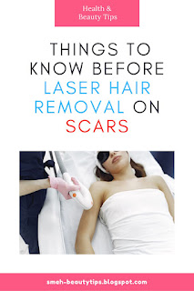 Laser Hair Removal on Scars