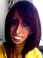 Lizzie Velásquez