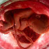 Το κοτόπουλο στην εγκυμοσύνη συρρικνώνει το ανδρικό μόριο στο έμβρυο!