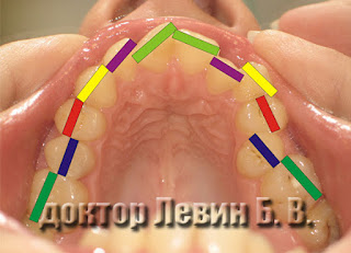 Дефицит места