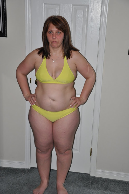 Before Picture