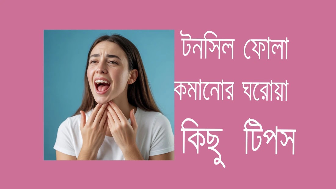 টনসিল ফোলা কমানোর ঘরোয়া কিছু  টিপস