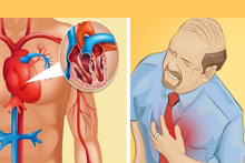 Be Careful: Your Body Alerts These 6 Symptoms One Month Before A Heart Attack! 