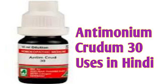 Antimonium Crudum 30 Uses in Hindi