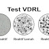 Obat Vdrl Tpha Resep Dokter Di Apotik Umum 