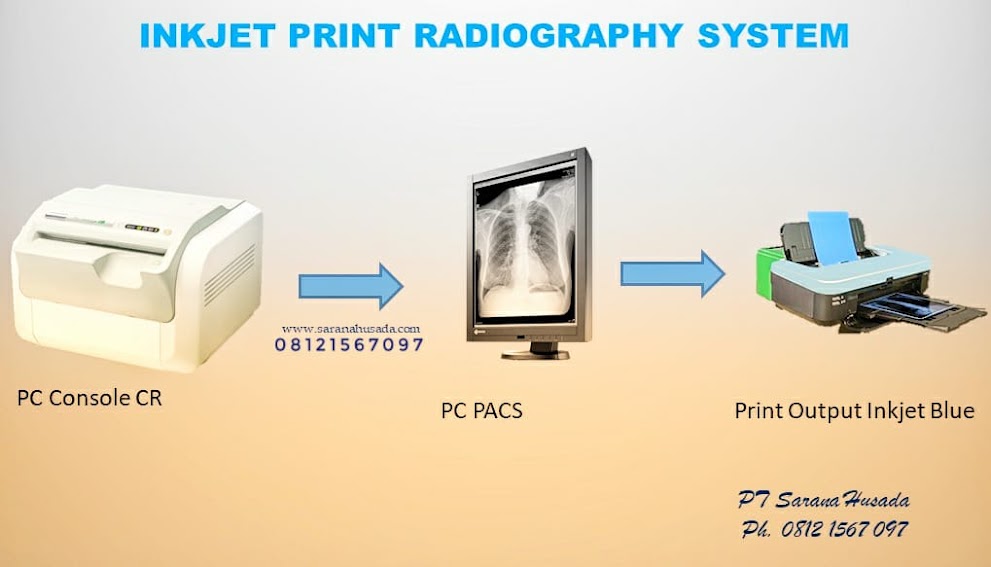 INKJET PRINT RADIOGRAPHY SYSTEM