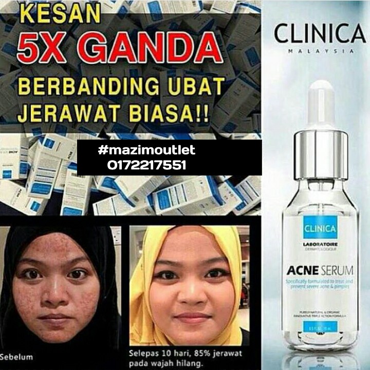 Mazim's Beauty Outlet: Clinica Acne Serum : Ubat Jerawat 