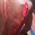 Osun Poly Staff Stabs During Exam