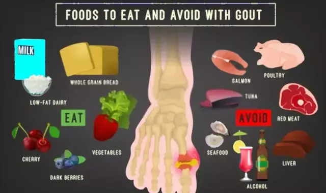 Foods to Avoid with Gout