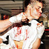 Ömlött a vér Justin Bieber szájából