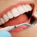 Quy trình bọc răng sứ chỉnh hô tại nha khoa 