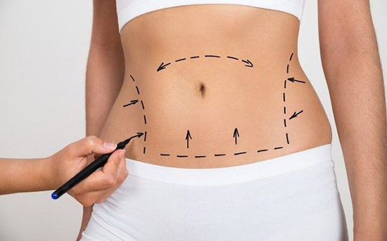 Cirurgia plástica, qual é a idade certa para fazer?